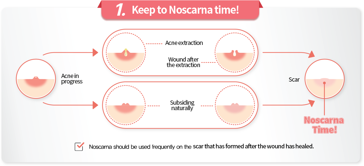 Dong- A Pharm – Noscarna Gel 20g